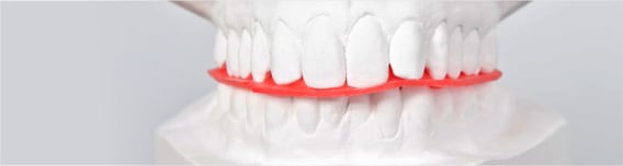 Removable Dentures