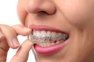 Dental Patient Holding Clear Braces