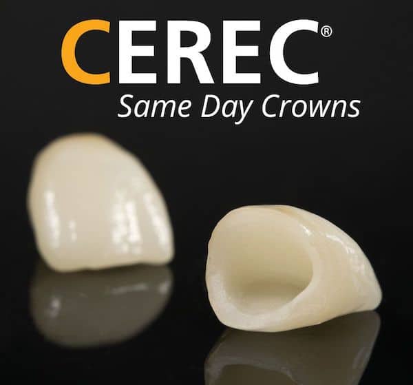 CEREC Crowns